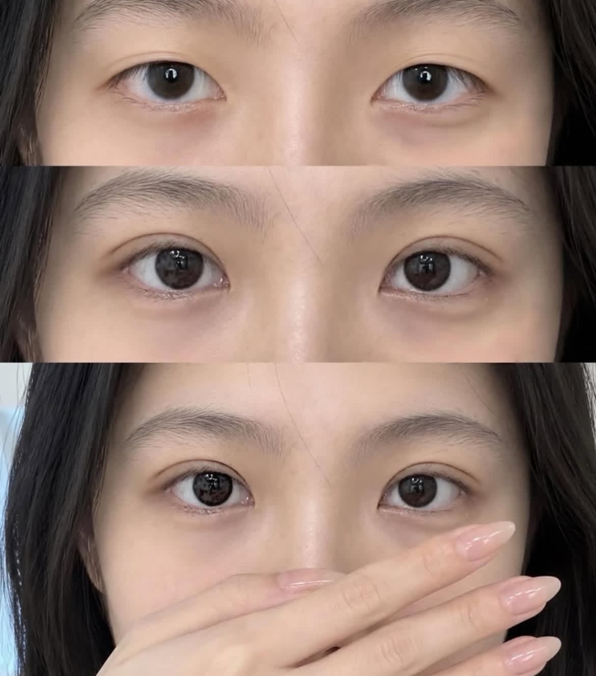 Three-panel comparison showing a woman's eyes transitioning from monolids to defined double eyelid creases.
